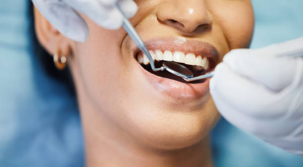 Best Mobile Emergency Dentist in Folsom, CA